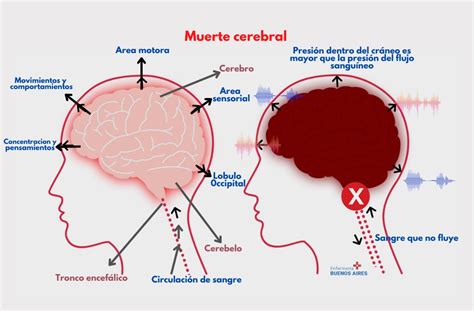 el coman|muerte cerebral vs coma.